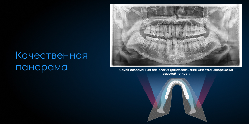 RAY Quantum 10×10 панорама Frame 11.jpg