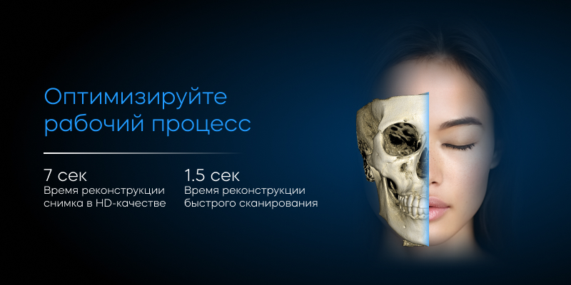 RAY Quantum 10×10 скорость реконструкции Frame 9.jpg